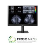 Ecran LG mammographie 31HN713D – 12 MP